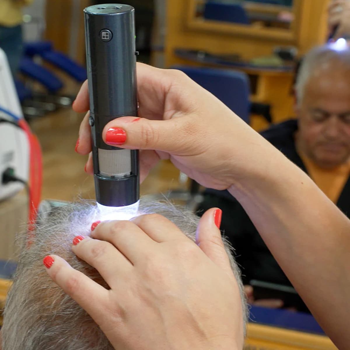 Crioterapia capilar en Vigo